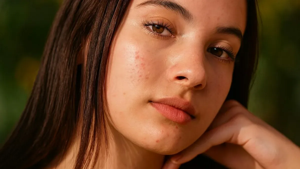 comment enlever les boutons sur le visage — Comment enlever les boutons sur le visage